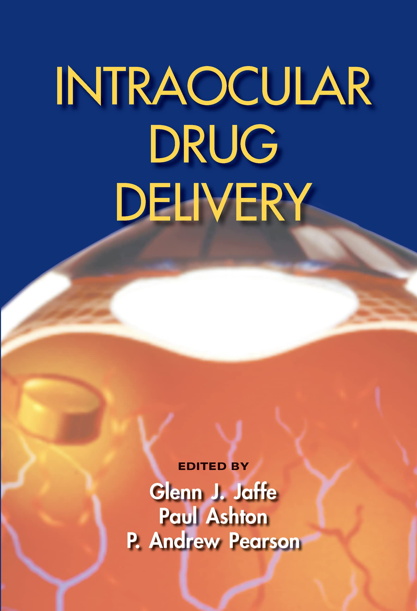 Intraocular Drug Delivery,Used