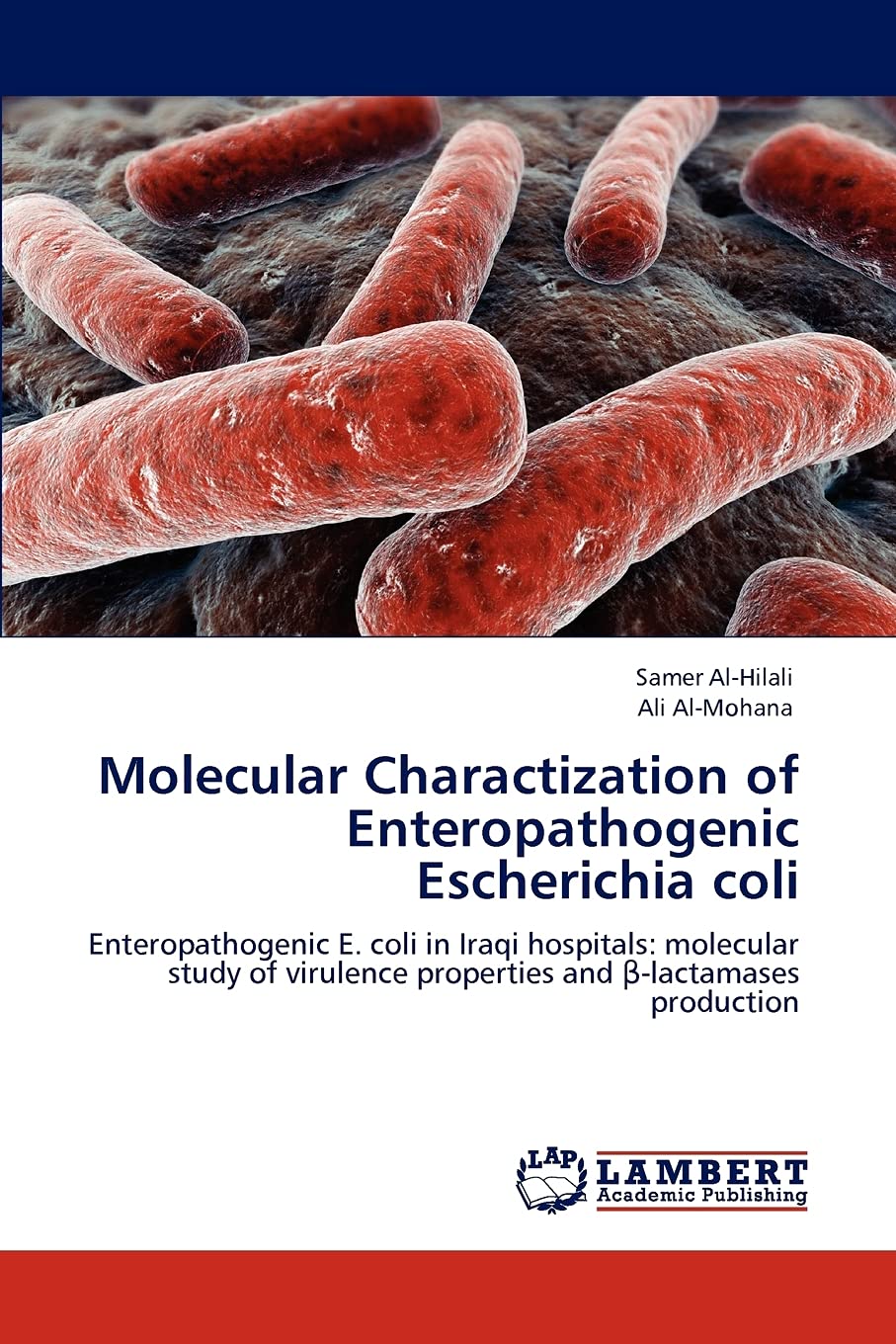 Molecular Charactization of Enteropathogenic Escherichia coli: Enteropathogenic E. coli in Iraqi hospitals: molecular study of v,Used