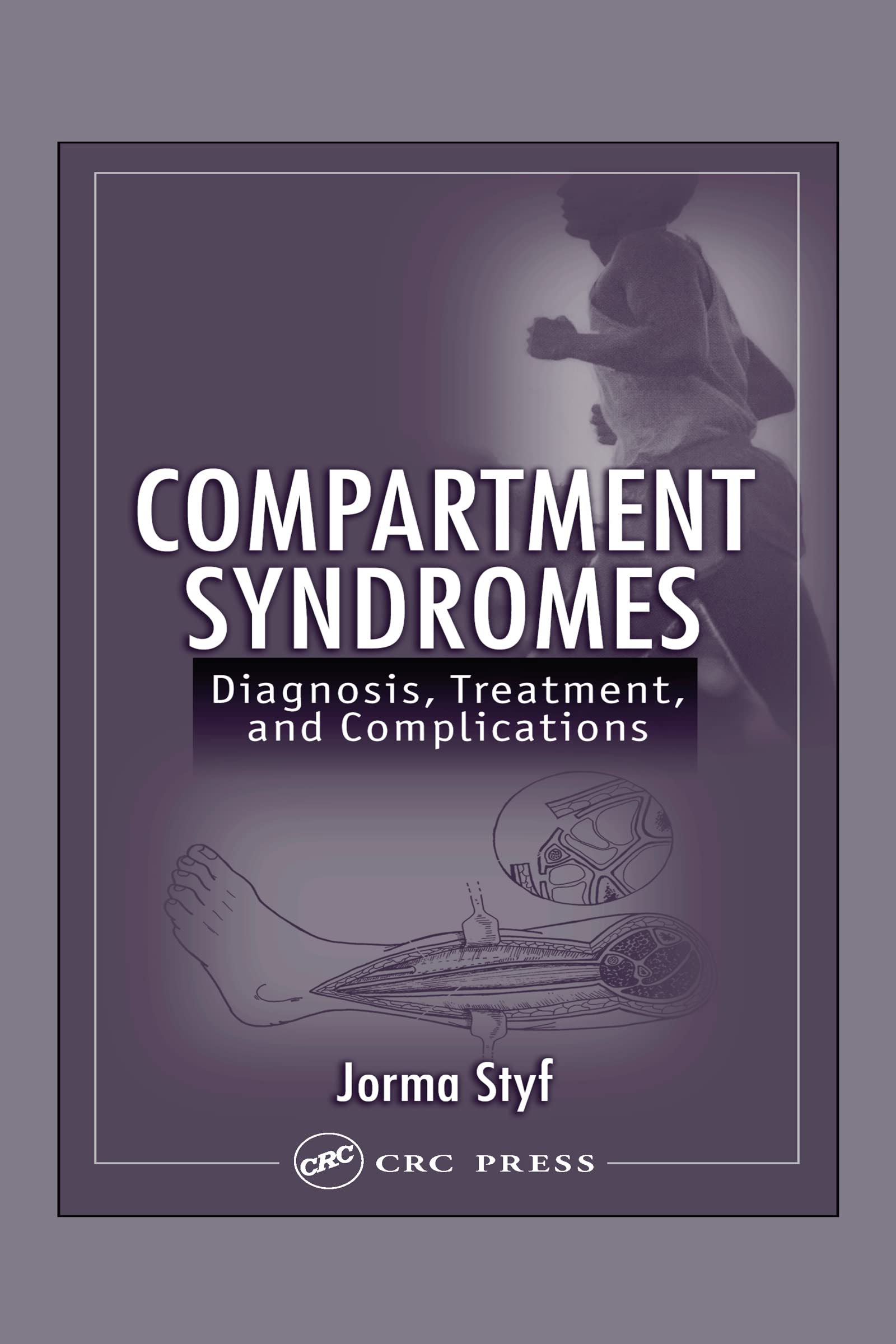 Compartment Syndromes: Diagnosis, Treatment, and Complications,Used