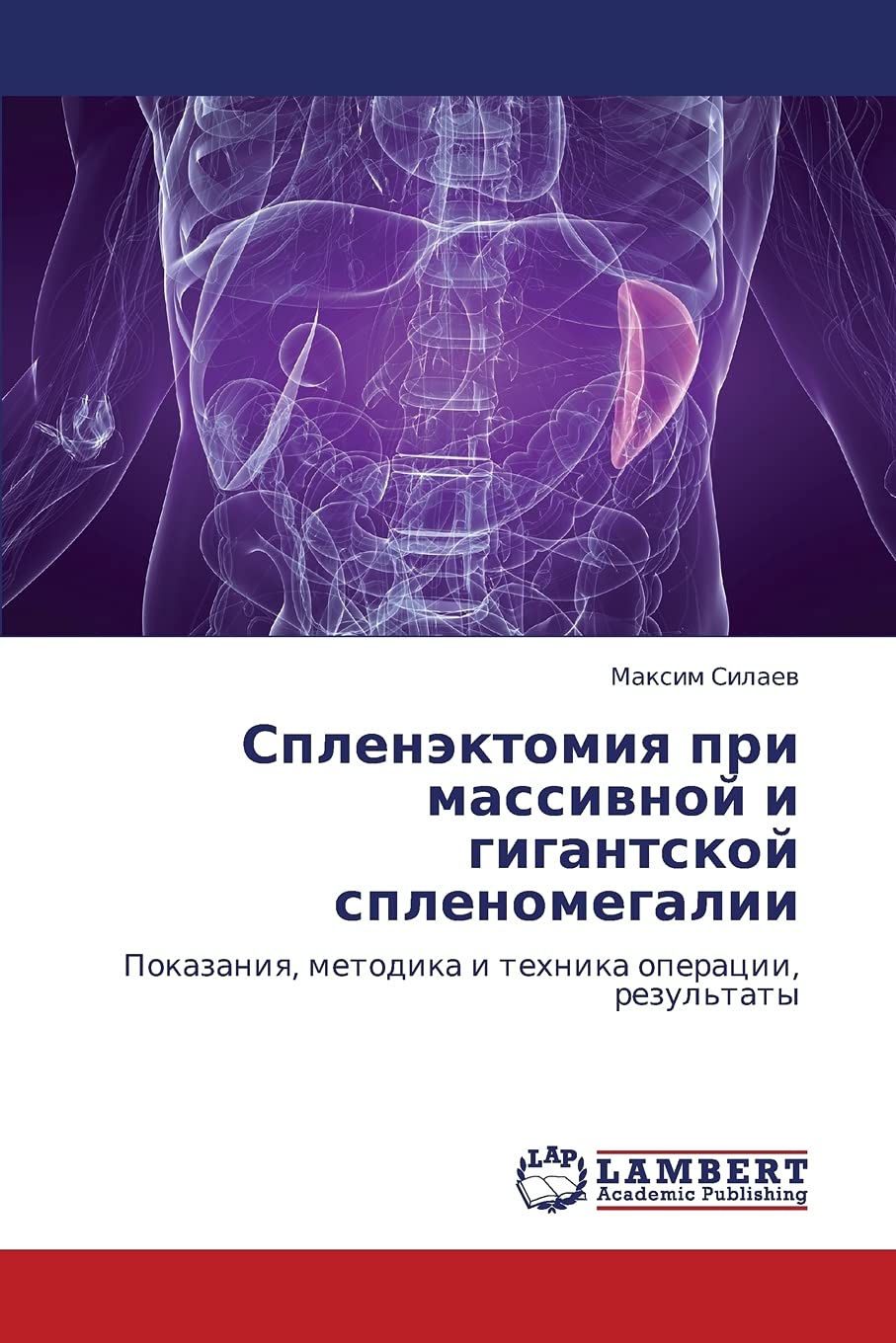Splenektomiya pri massivnoy i gigantskoy splenomegalii: Pokazaniya, metodika i tekhnika operatsii, rezul'taty (Russian Edition),Used