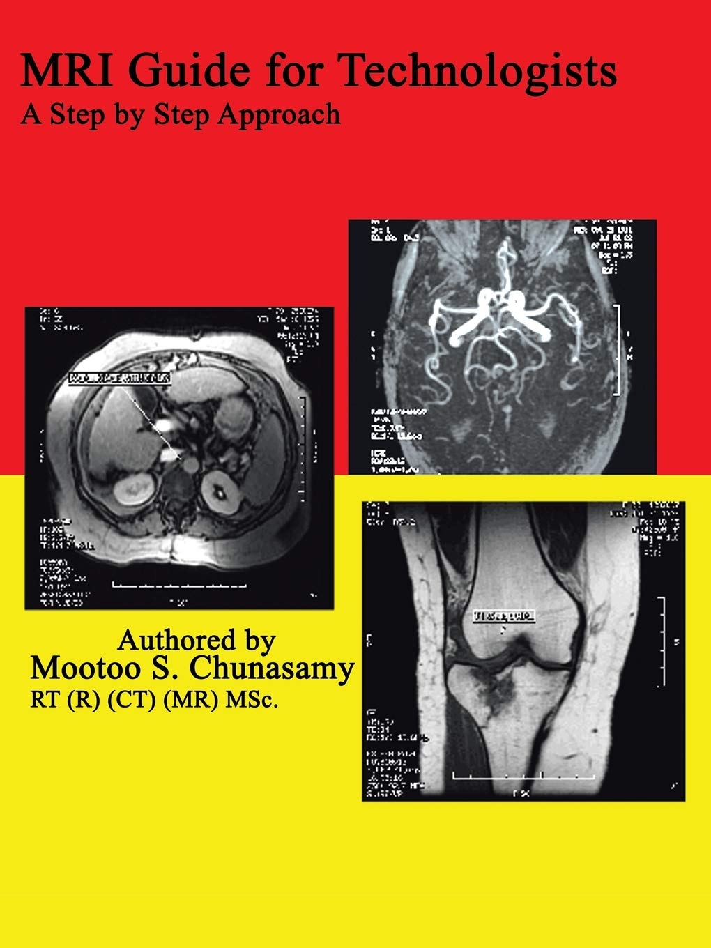 MRI Guide for Technologists: A Step by Step Approach,Used
