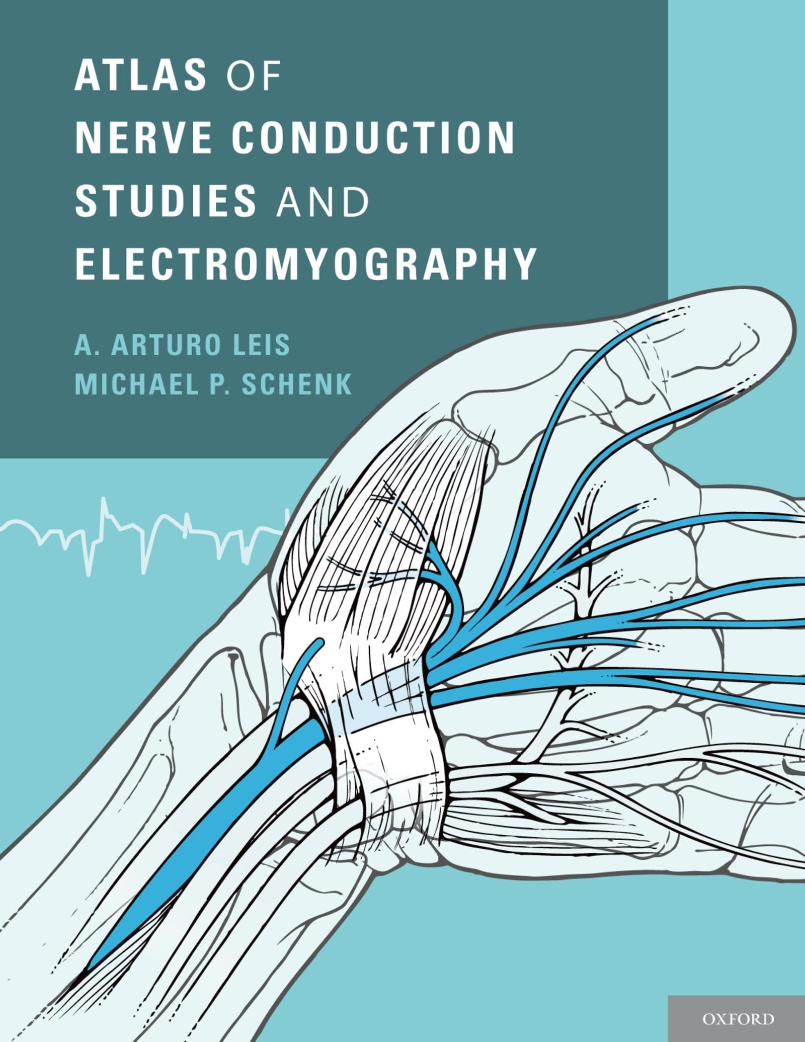 Atlas of Nerve Conduction Studies and Electromyography,Used