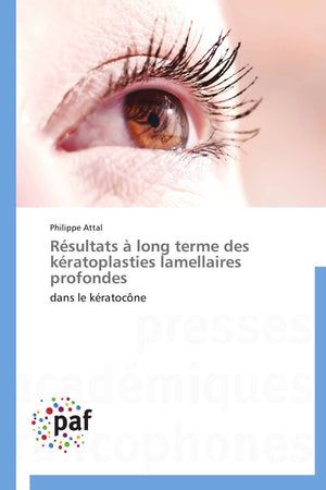Rsultats  long terme des kratoplasties lamellaires profondes: dans le kratocne (Omn.Pres.Franc.) (French Edition),Used