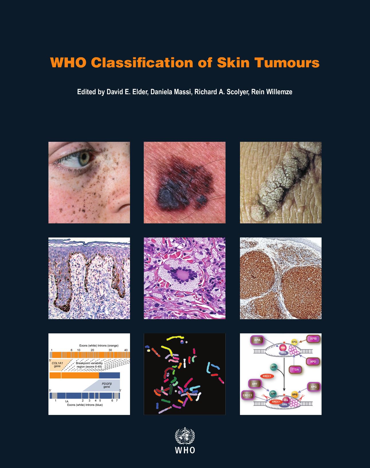 WHO Classification of Skin Tumours (WHO Classification of Tumours),Used