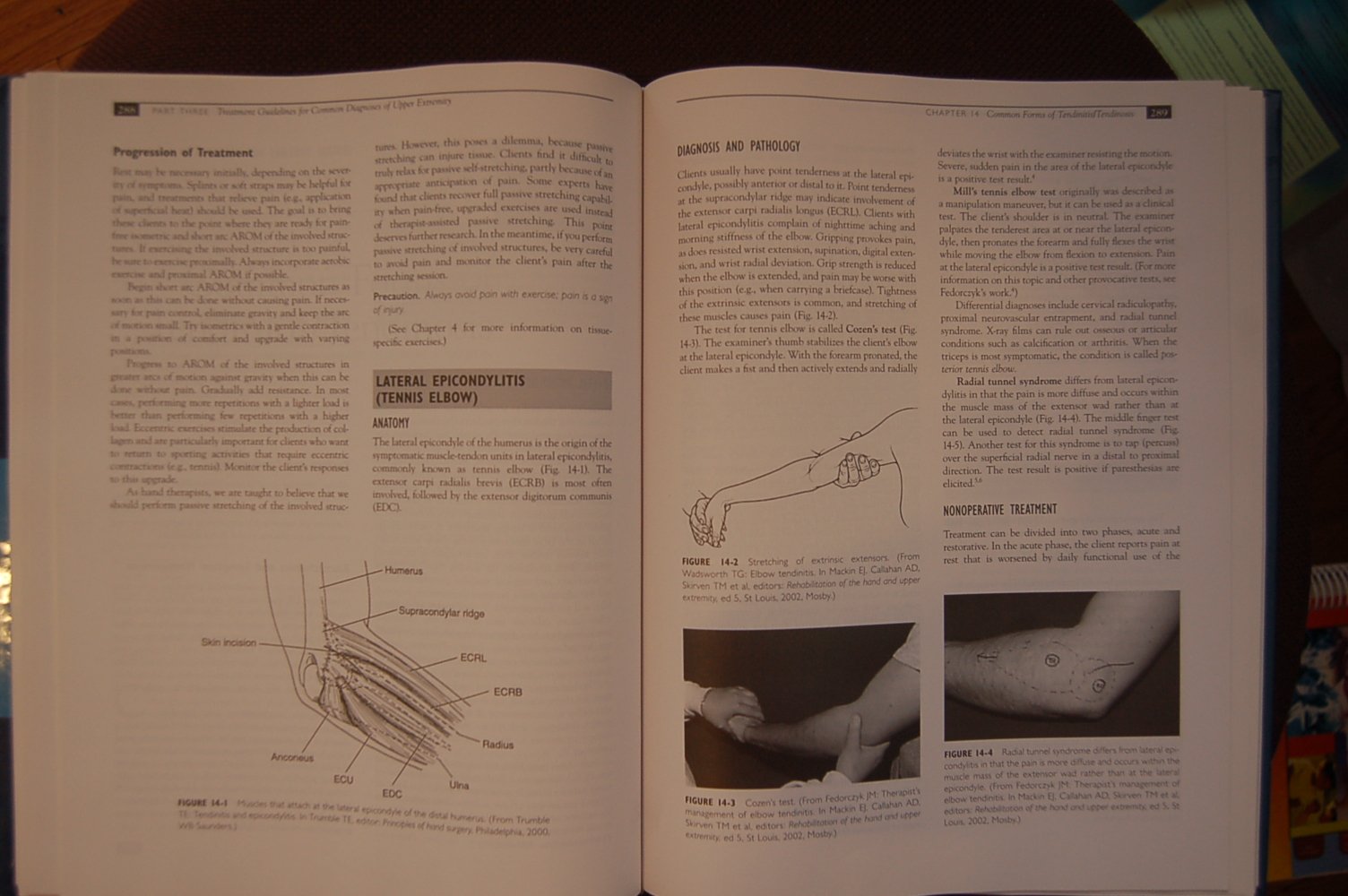 Fundamentals of Hand Therapy: Clinical Reasoning and Treatment Guidelines for Common Diagnoses of the Upper Extremity,Used