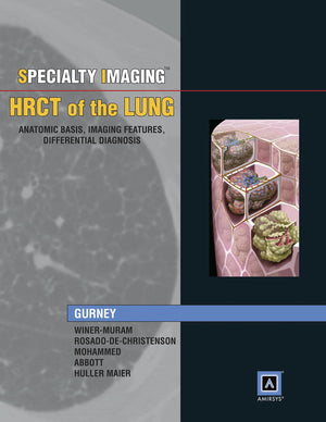 Specialty Imaging: HRCT of the Lung, Anatomic Basis, Imaging Features, Differential Diagnosis,Used