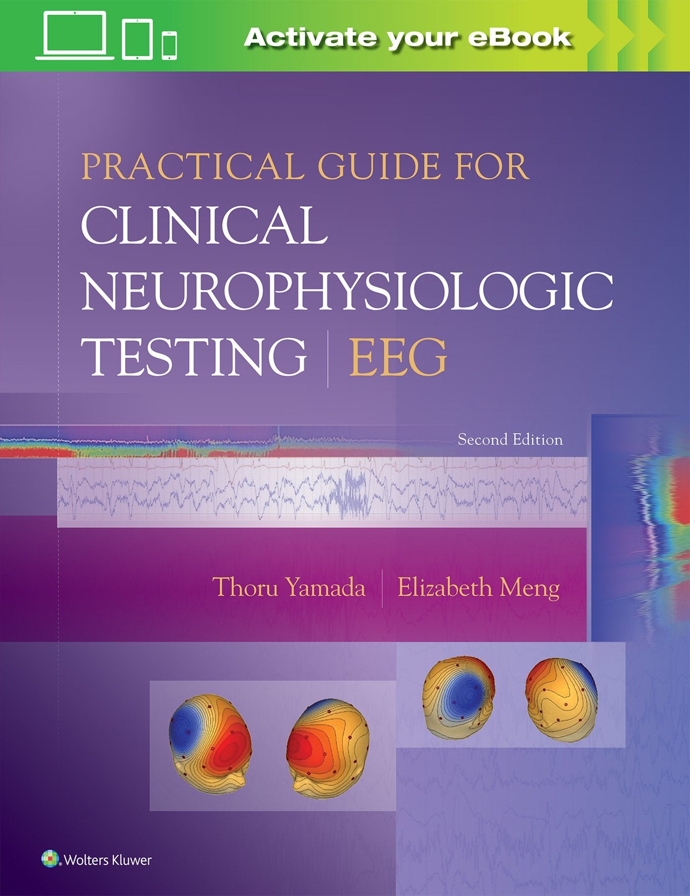 Practical Guide for Clinical Neurophysiologic Testing: EEG,Used