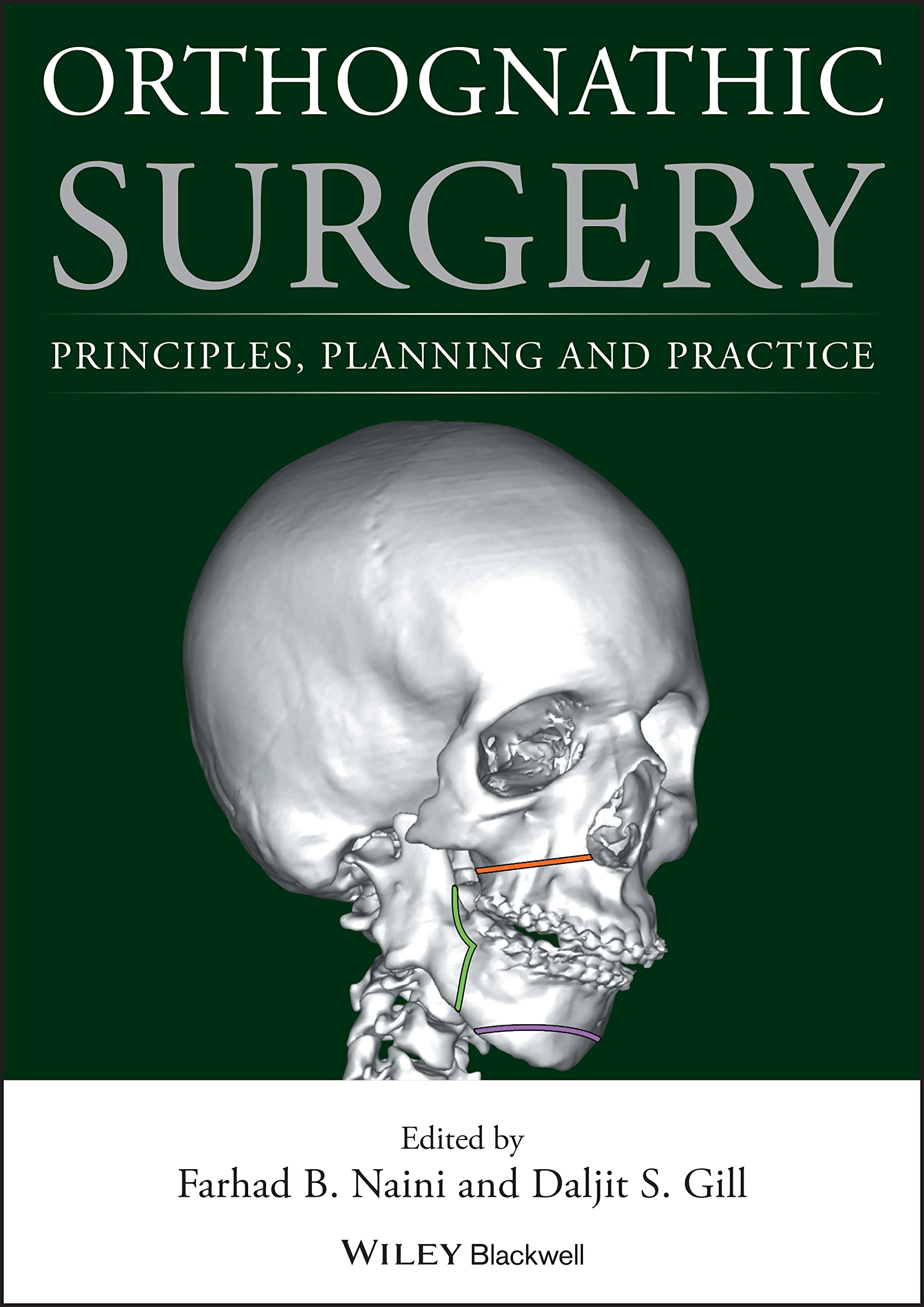 Orthognathic Surgery: Principles, Planning and Practice,Used