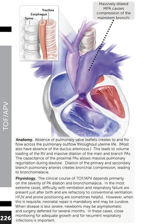 Boston Children's Hospital Cardiac ICU Manual For Bedside Providers  an illustrated handbook of congenital heart disease,New