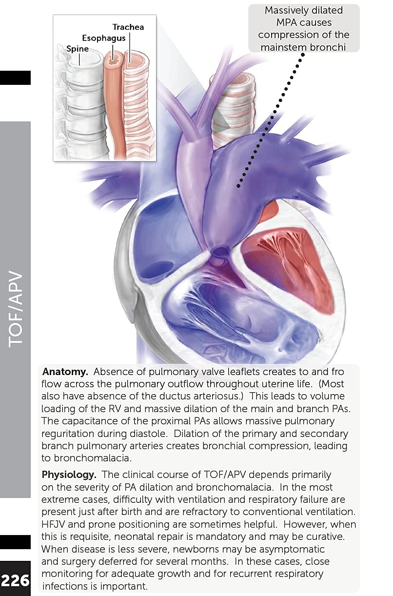 Boston Children's Hospital Cardiac ICU Manual For Bedside Providers  an illustrated handbook of congenital heart disease,New