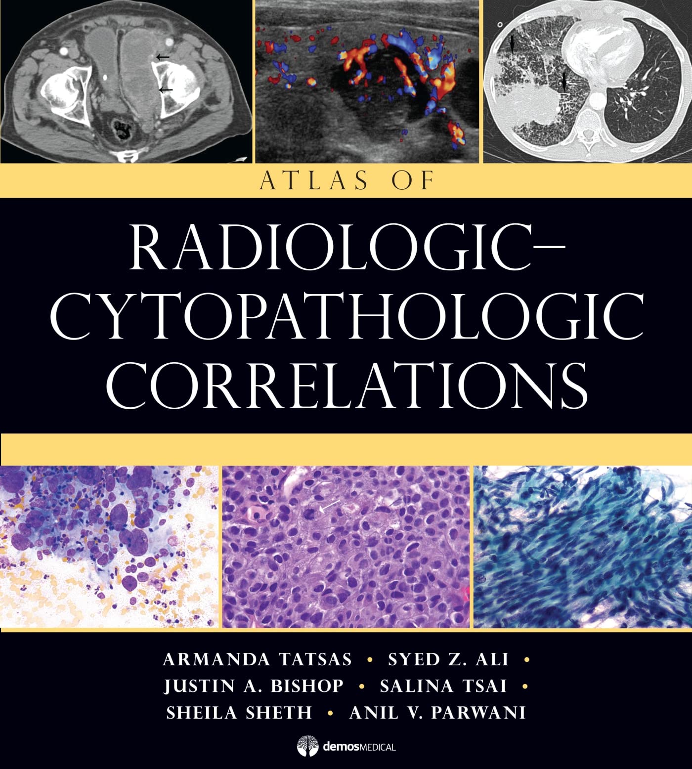 Atlas Of Radiologiccytopathologic Correlations,Used