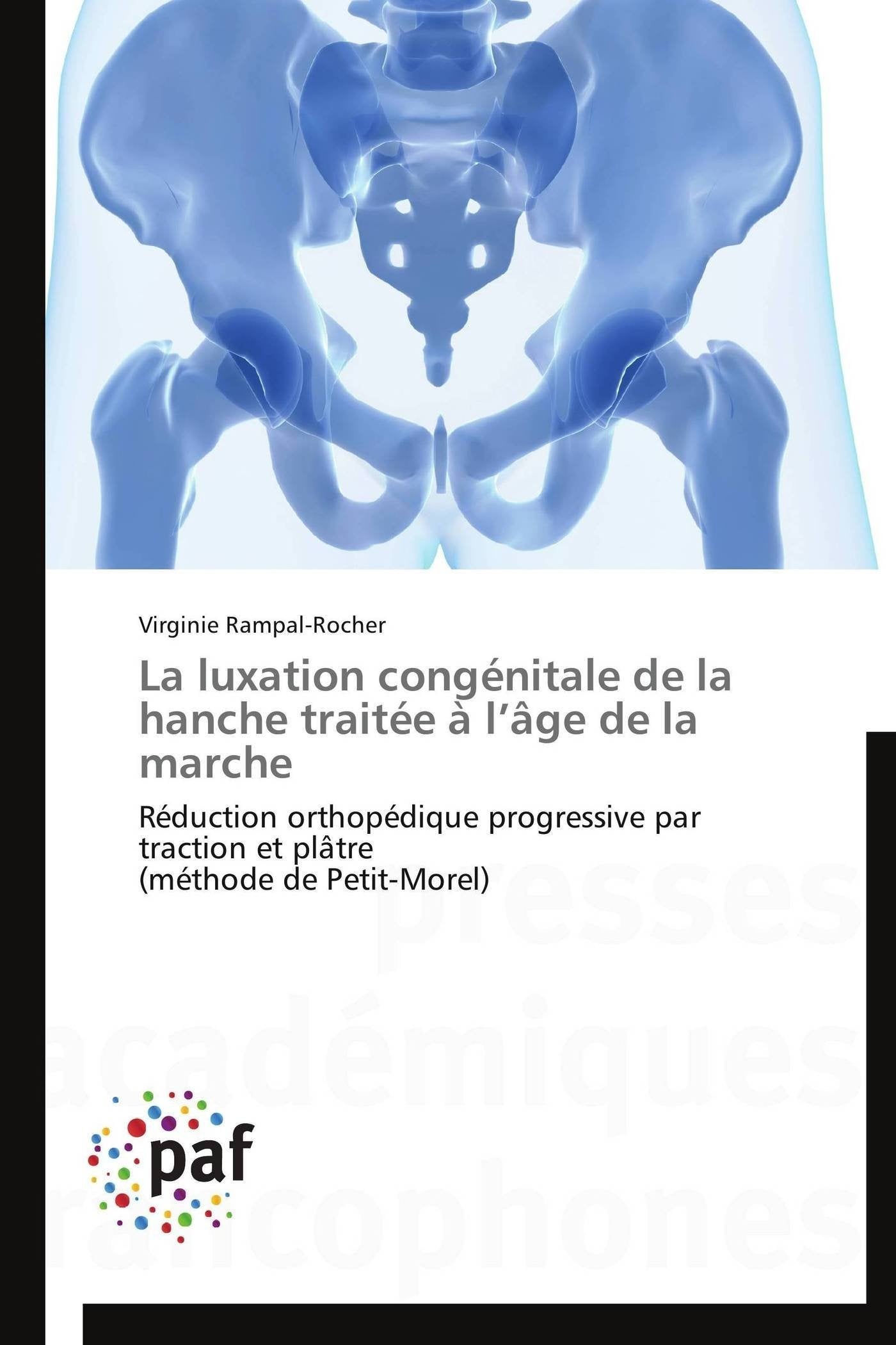 La luxation congnitale de la hanche traite  lge de la marche: Rduction orthopdique progressive par traction et pltre (m,Used