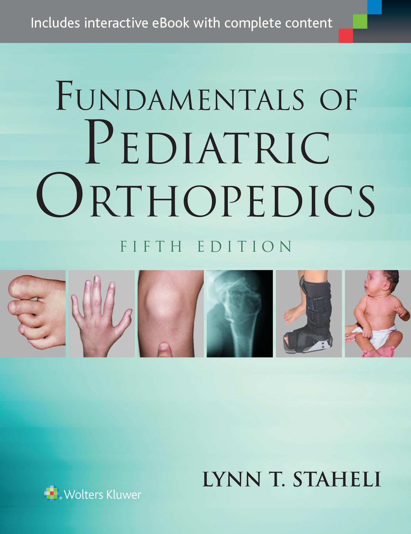 Fundamentals of Pediatric Orthopedics (Staheli, Fundamentals of Pediatric Orthopedics)