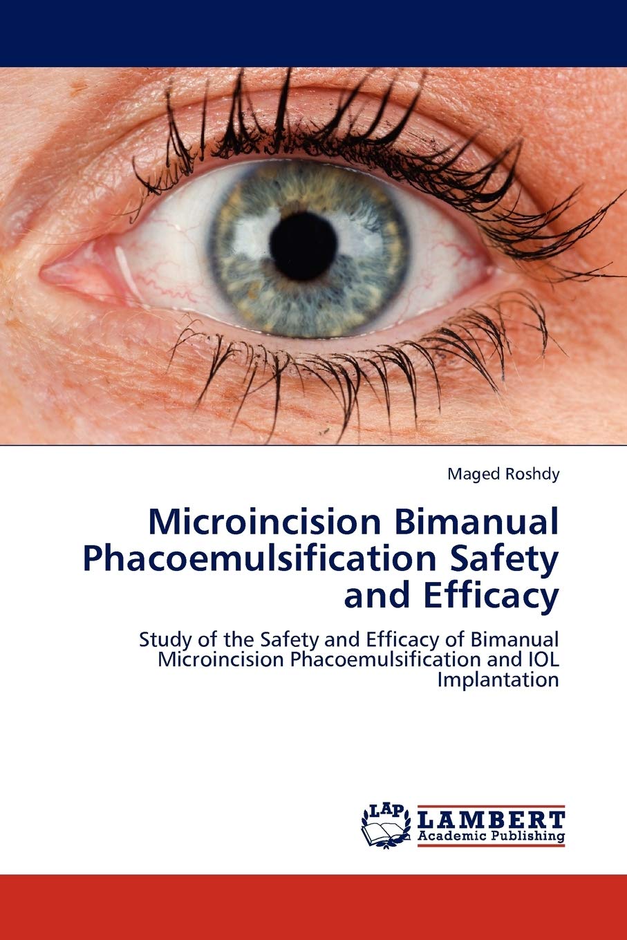 Microincision Bimanual Phacoemulsification Safety and Efficacy: Study of the Safety and Efficacy of Bimanual Microincision Phaco,Used