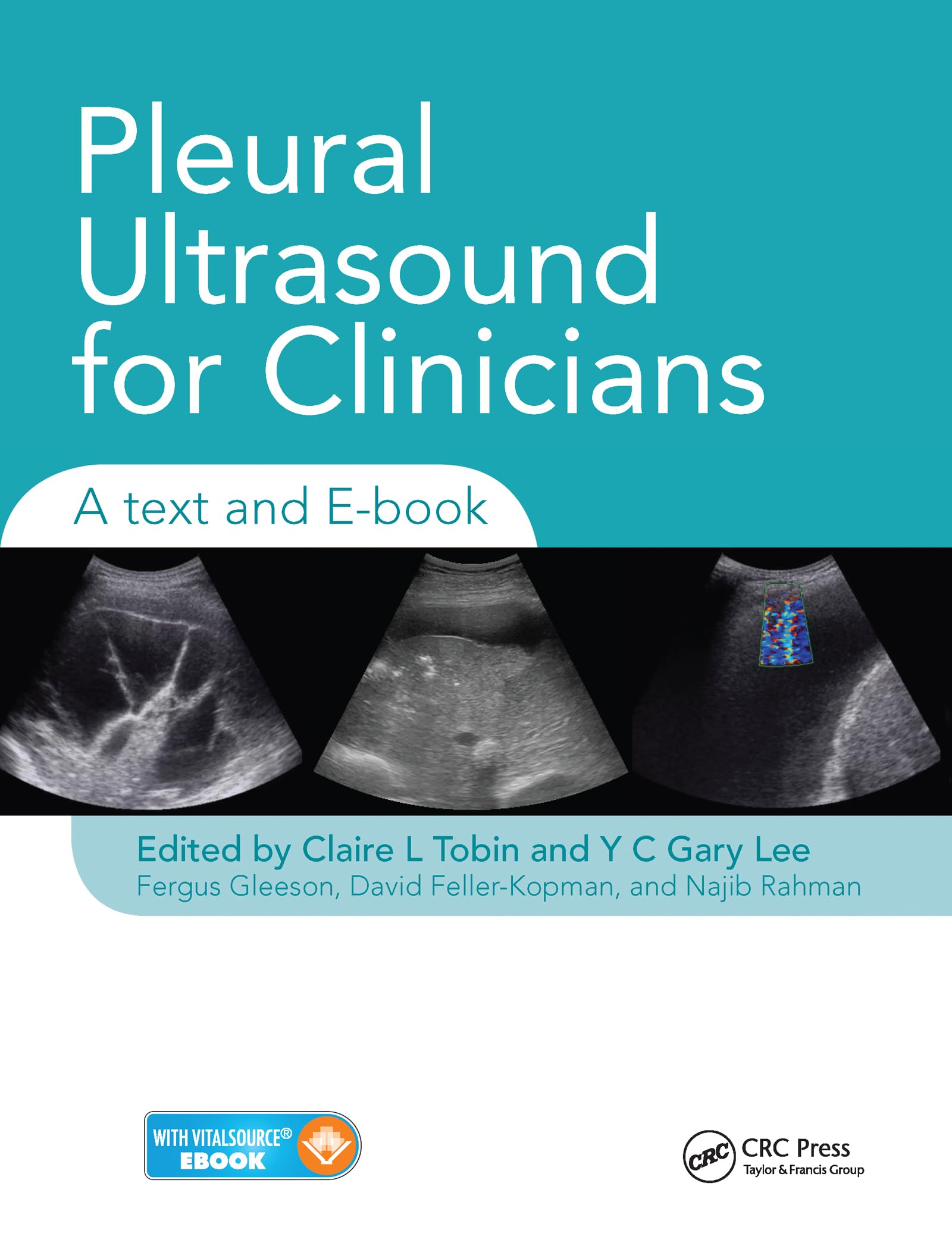Pleural Ultrasound for Clinicians: A Text and Ebook,Used