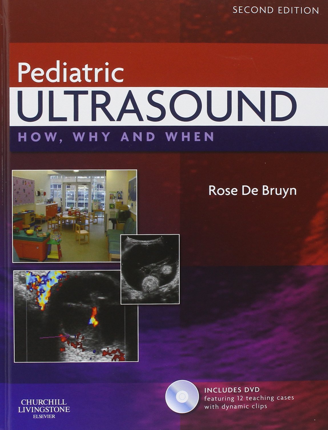 Pediatric Ultrasound: How, Why And When