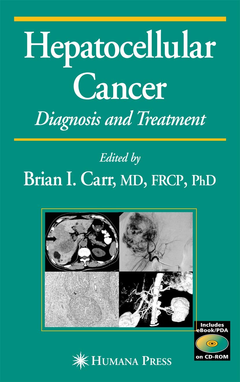 Hepatocellular Carcinoma: Diagnosis and Treatment, Second Edition (Current Clinical Oncology),New