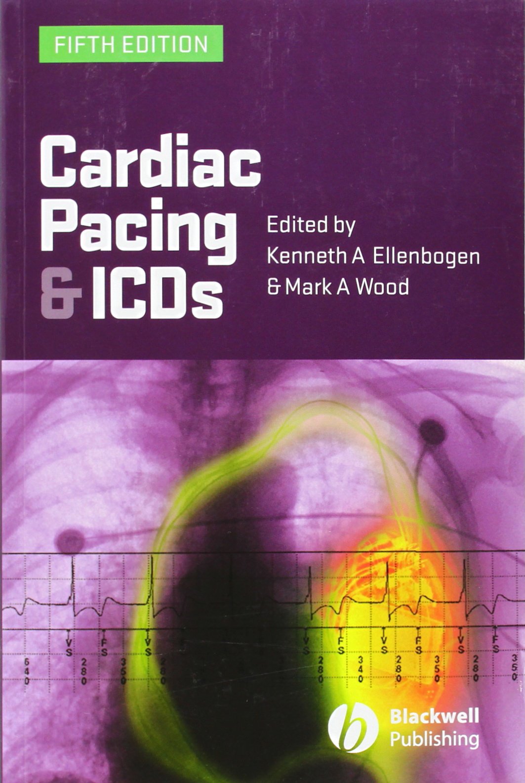 Cardiac Pacing And Icds