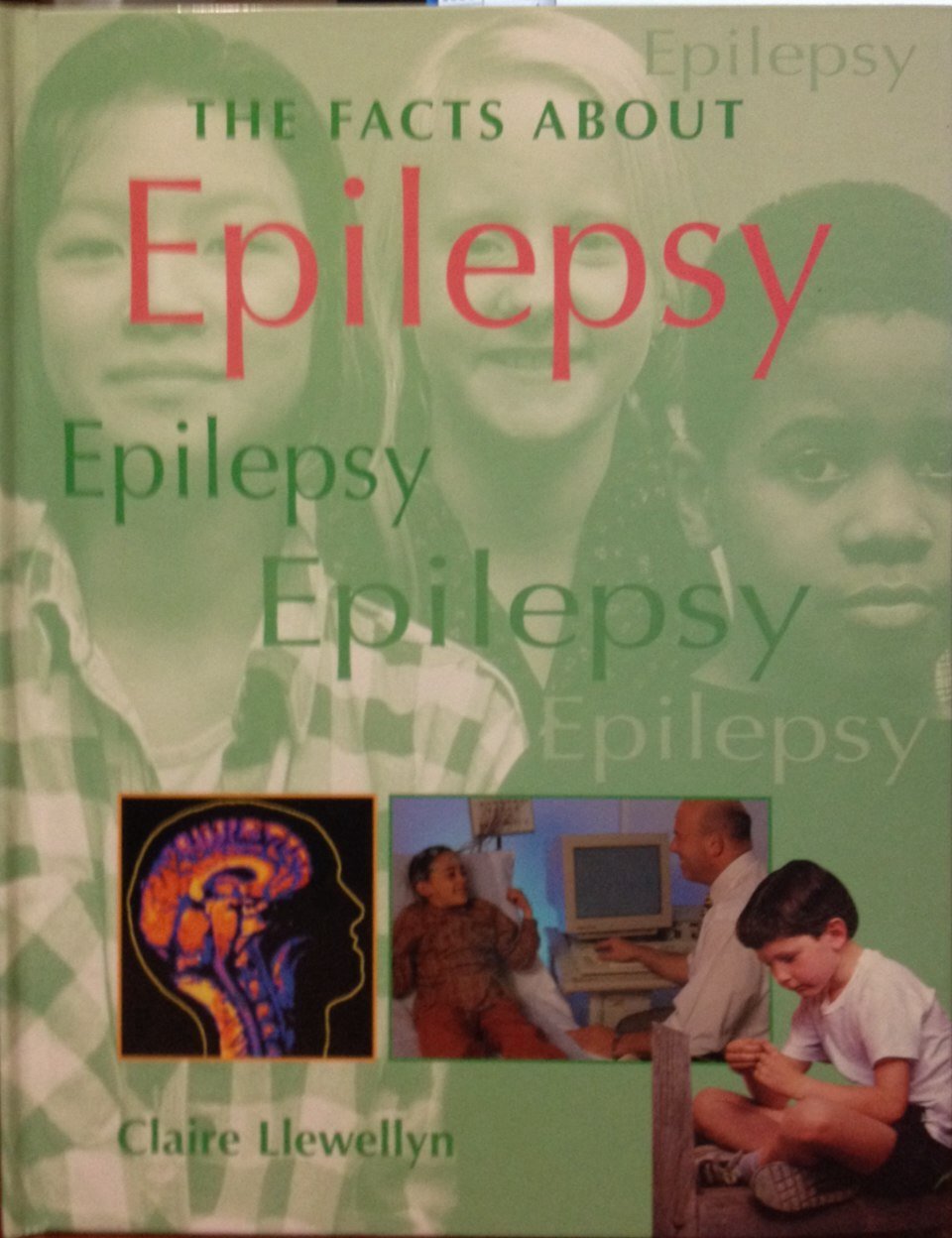 The Facts About Epilepsy,Used