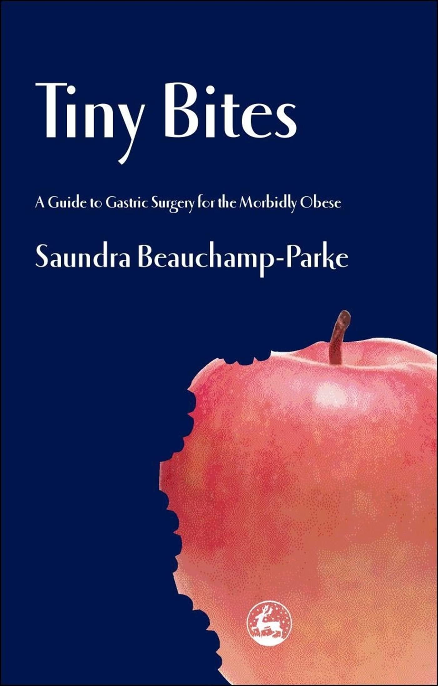 Tiny Bites: A Guide to Gastric Surgery for the Morbidly Obese,Used
