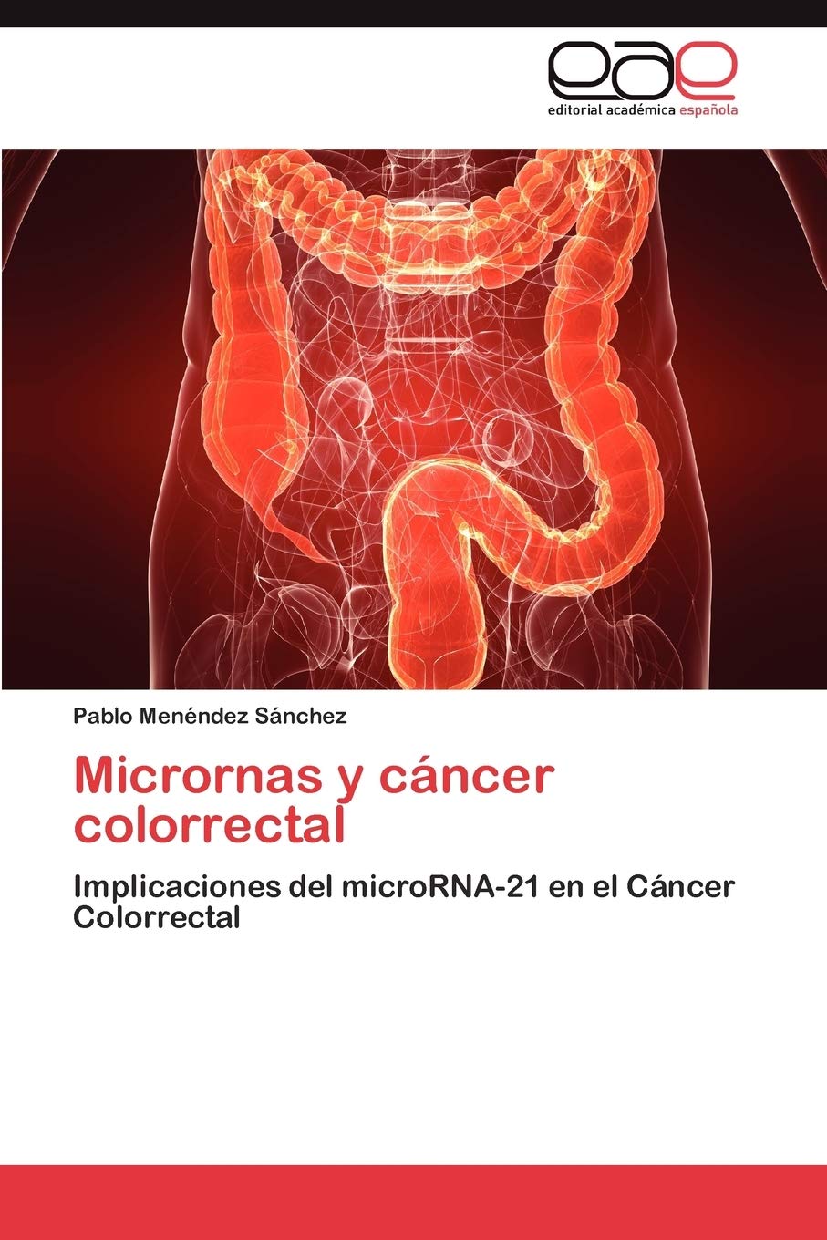 Micrornas y cncer colorrectal: Implicaciones del microRNA21 en el Cncer Colorrectal (Spanish Edition),Used