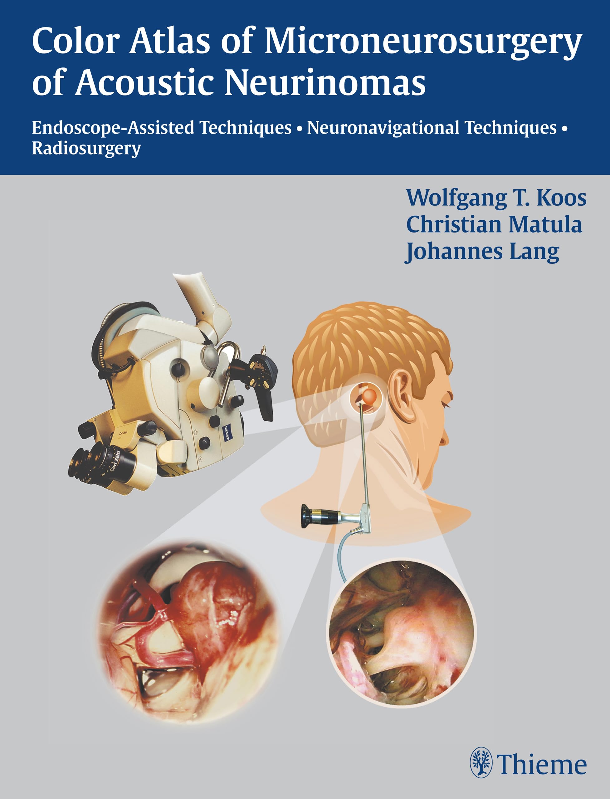 Color Atlas Of Microsurgery Of Acoustic Neurinomas: Endoscopeassisted Techniques  Neuronavigational Techniques  Radiosurgery,Used