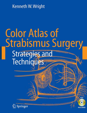 Color Atlas Of Strabismus Surgery: Strategies And Techniques