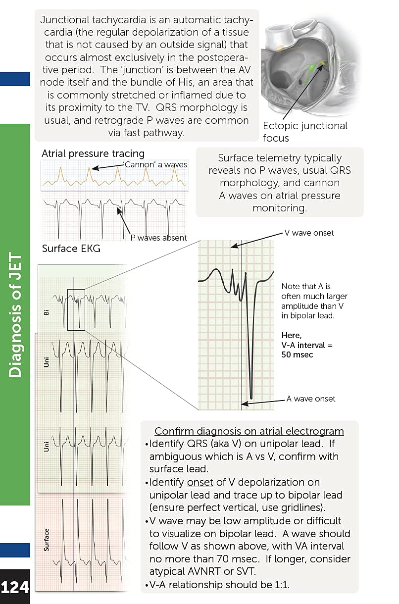 Boston Children's Hospital Cardiac ICU Manual For Bedside Providers  an illustrated handbook of congenital heart disease,New