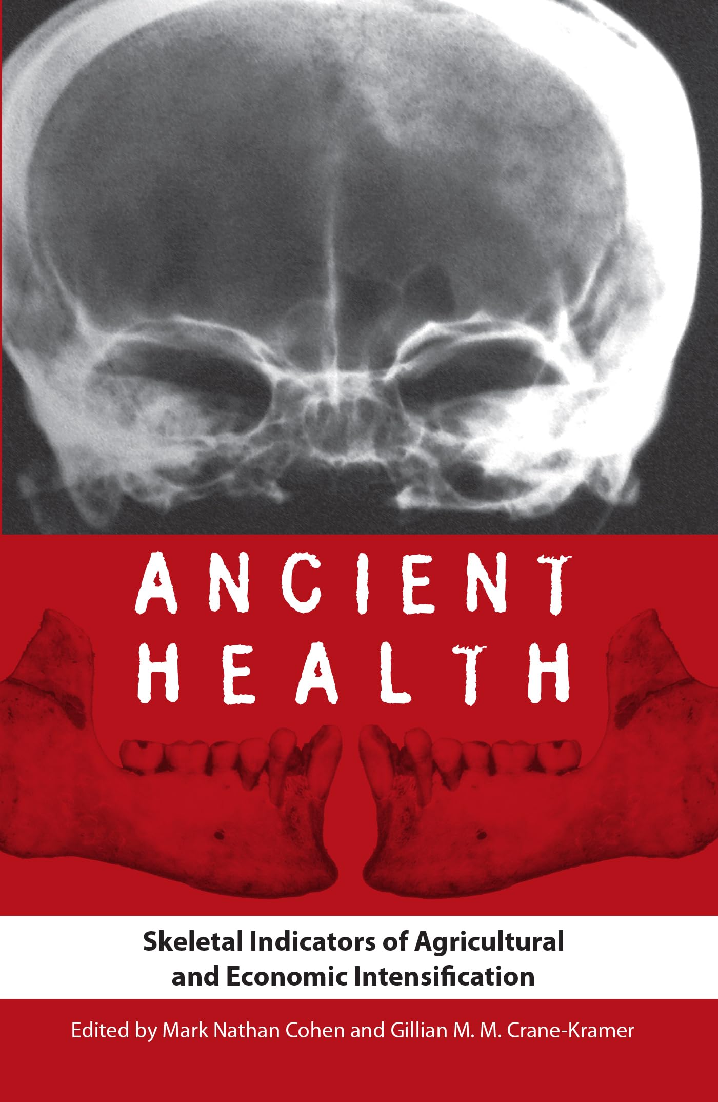 Ancient Health: Skeletal Indicators of Agricultural and Economic Intensification (Bioarchaeological Interpretations of the Human,Used