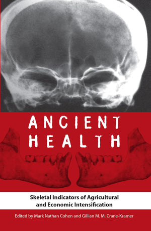 Ancient Health: Skeletal Indicators of Agricultural and Economic Intensification (Bioarchaeological Interpretations of the Human,Used