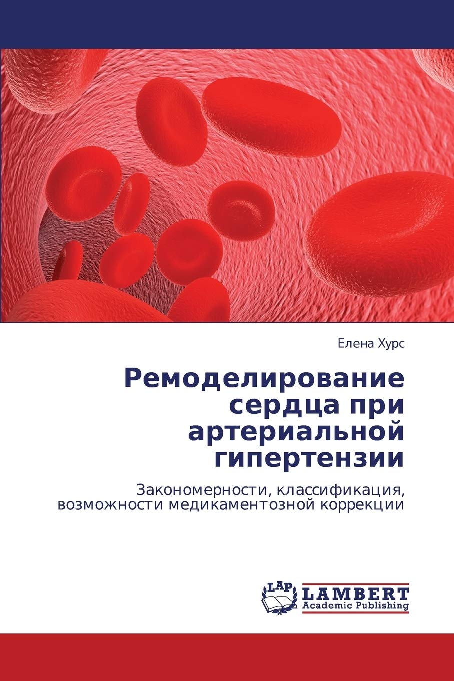 Remodelirovanie serdtsa pri arterial'noy gipertenzii: Zakonomernosti, klassifikatsiya, vozmozhnosti medikamentoznoy korrektsii (,Used