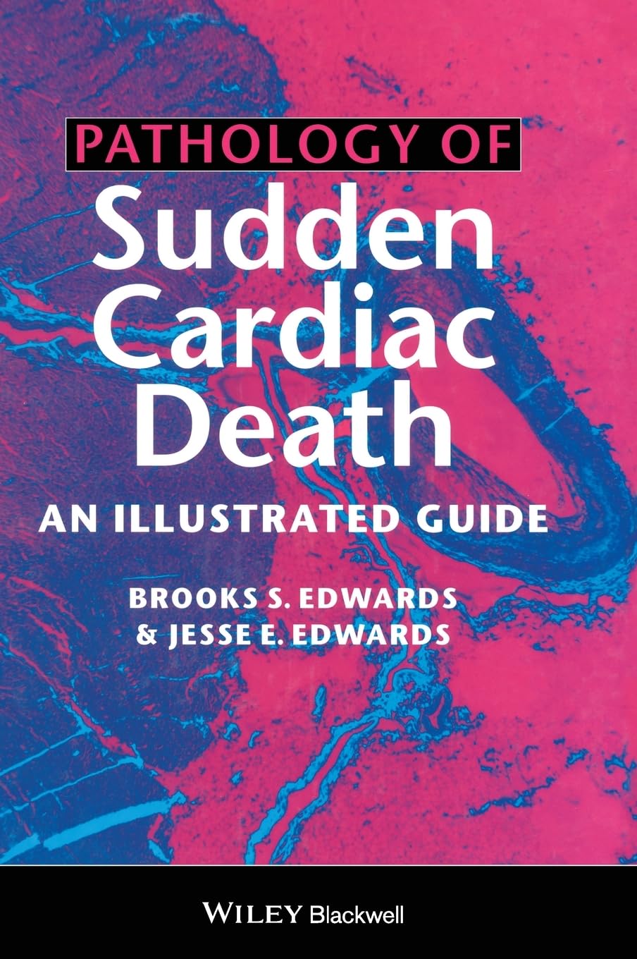 Pathology of Sudden Cardiac Death: An Illustrated Guide,Used