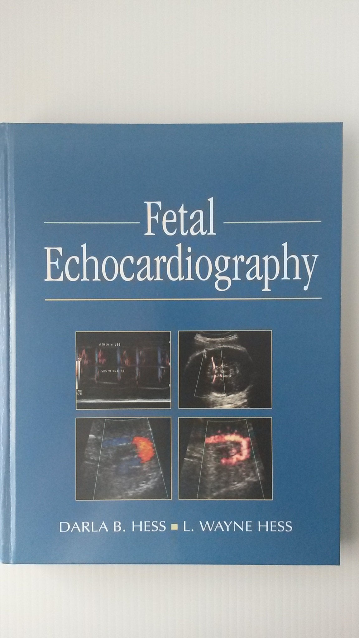 Fetal Echocardiography,Used