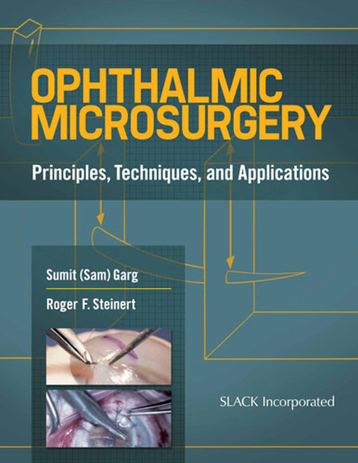 Ophthalmic Microsurgery: Principles, Techniques, And Applications,Used
