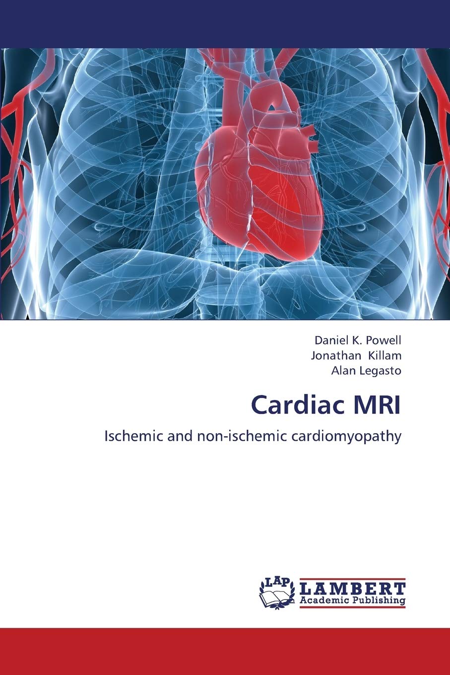 Cardiac MRI: Ischemic and nonischemic cardiomyopathy,Used