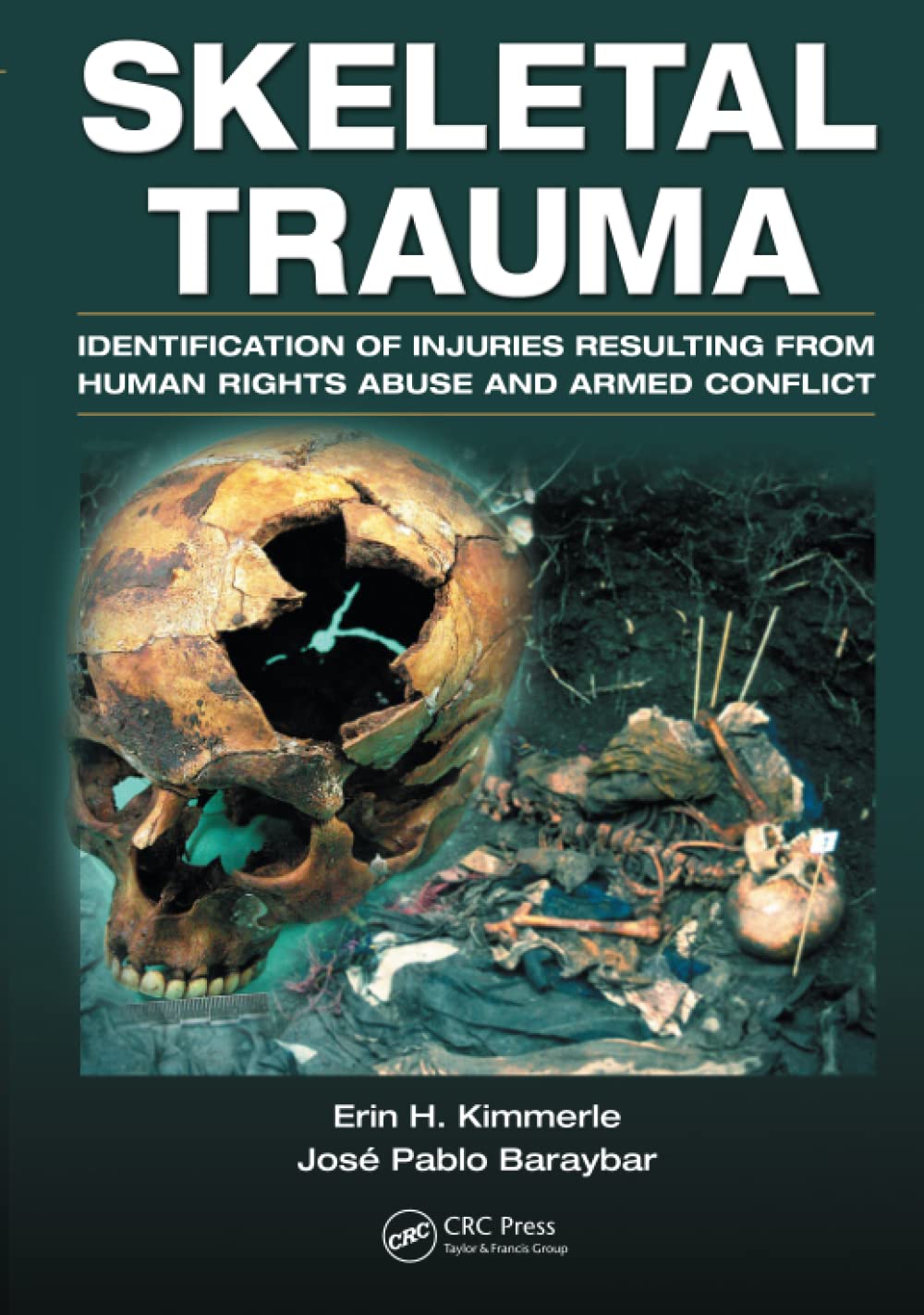 Skeletal Trauma,Used