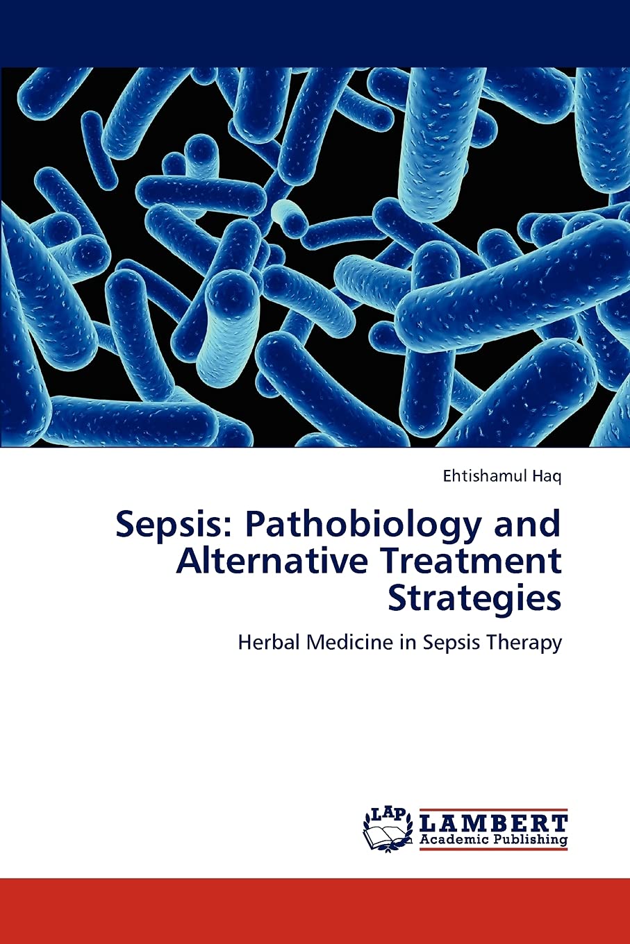 Sepsis: Pathobiology and Alternative Treatment Strategies: Herbal Medicine in Sepsis Therapy,Used