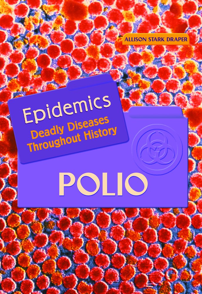 Polio (Epidemics)