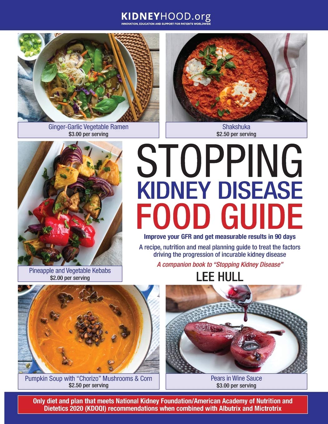 Stopping Kidney Disease Food Guide: A Recipe, Nutrition And Meal Planning Guide To Treat The Factors Driving The Progression Of ,Used