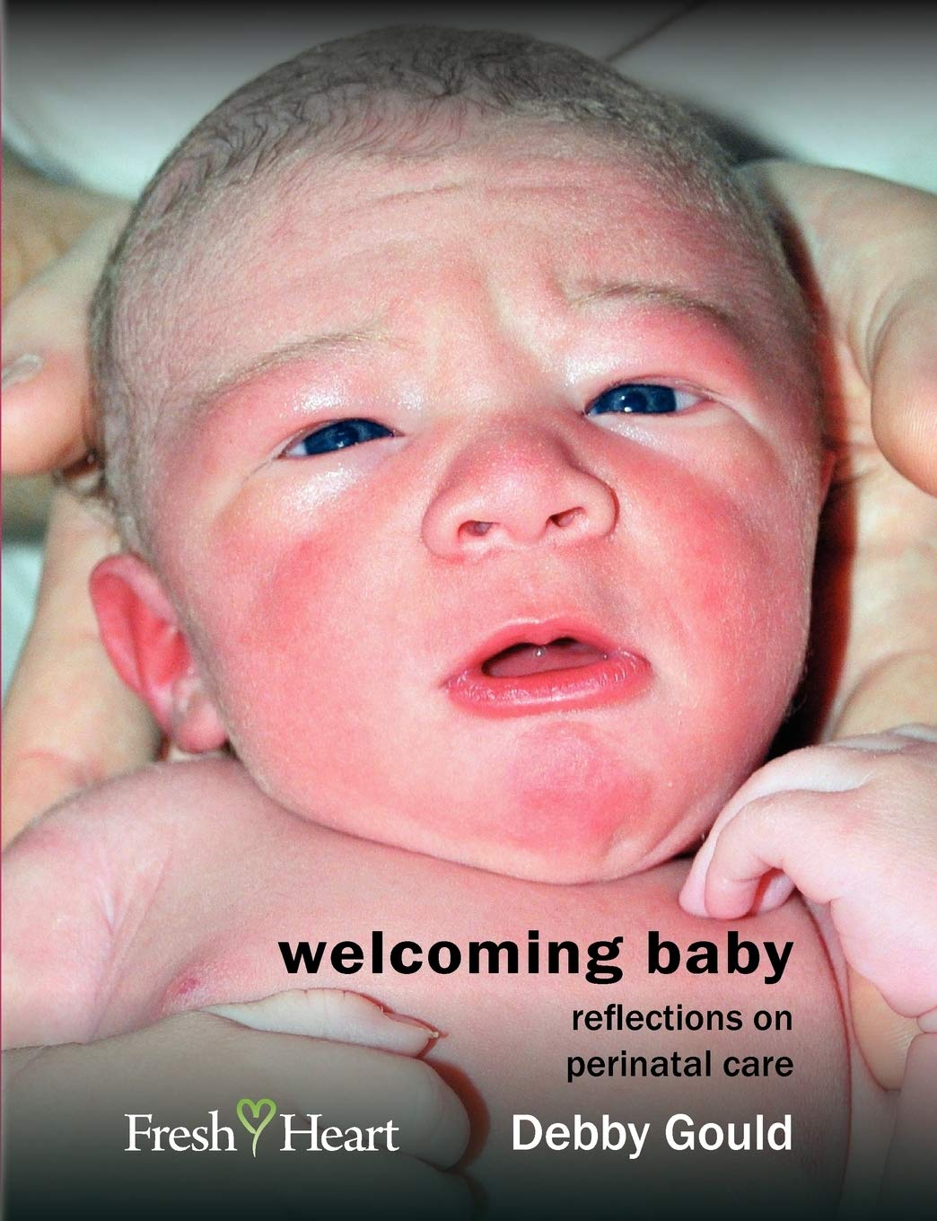 Welcoming Baby: Reflections On Perinatal Care (Fresh Heart Books For Better Birth),Used