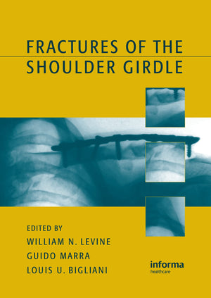 Fractures of the Shoulder Girdle,Used