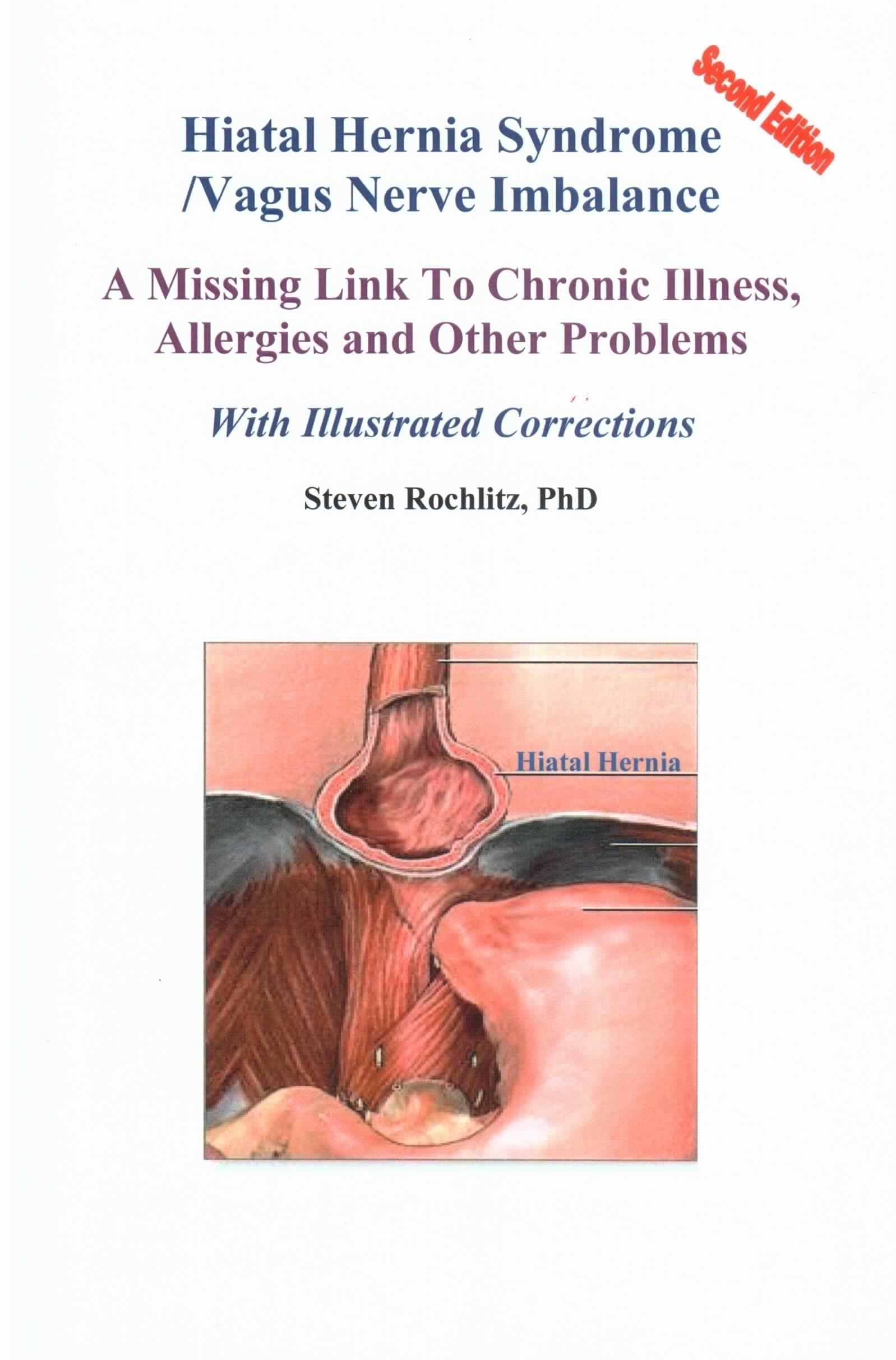 Hiatal Hernia Syndrome/Vagus Nerve Imbalance: The Most Common Health Syndrome In Mankind, With Illustrated Selfhelp Corrections,New