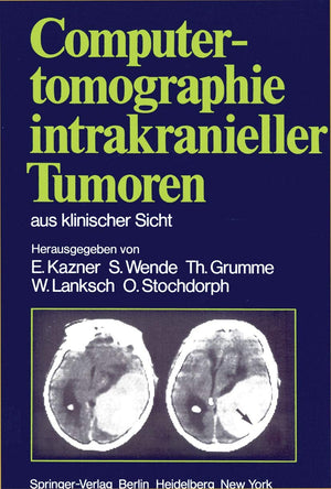 Computertomographie intrakranieller Tumoren aus klinischer Sicht (German Edition),Used
