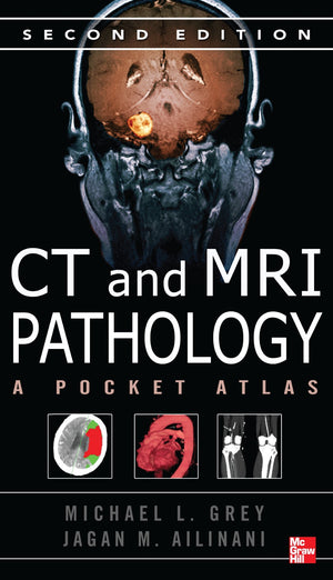 Ct & Mri Pathology: A Pocket Atlas, Second Edition