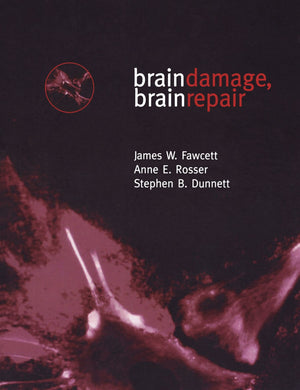 Brain Damage, Brain Repair,Used