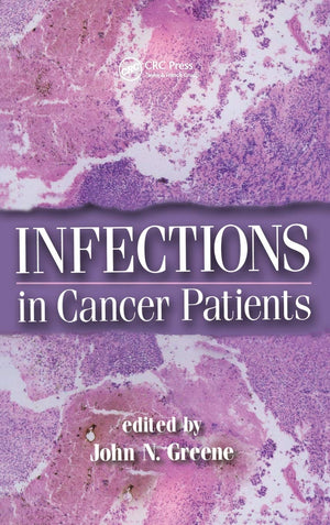 Infections In Cancer Patients (Basic And Clinical Oncology, 29),Used