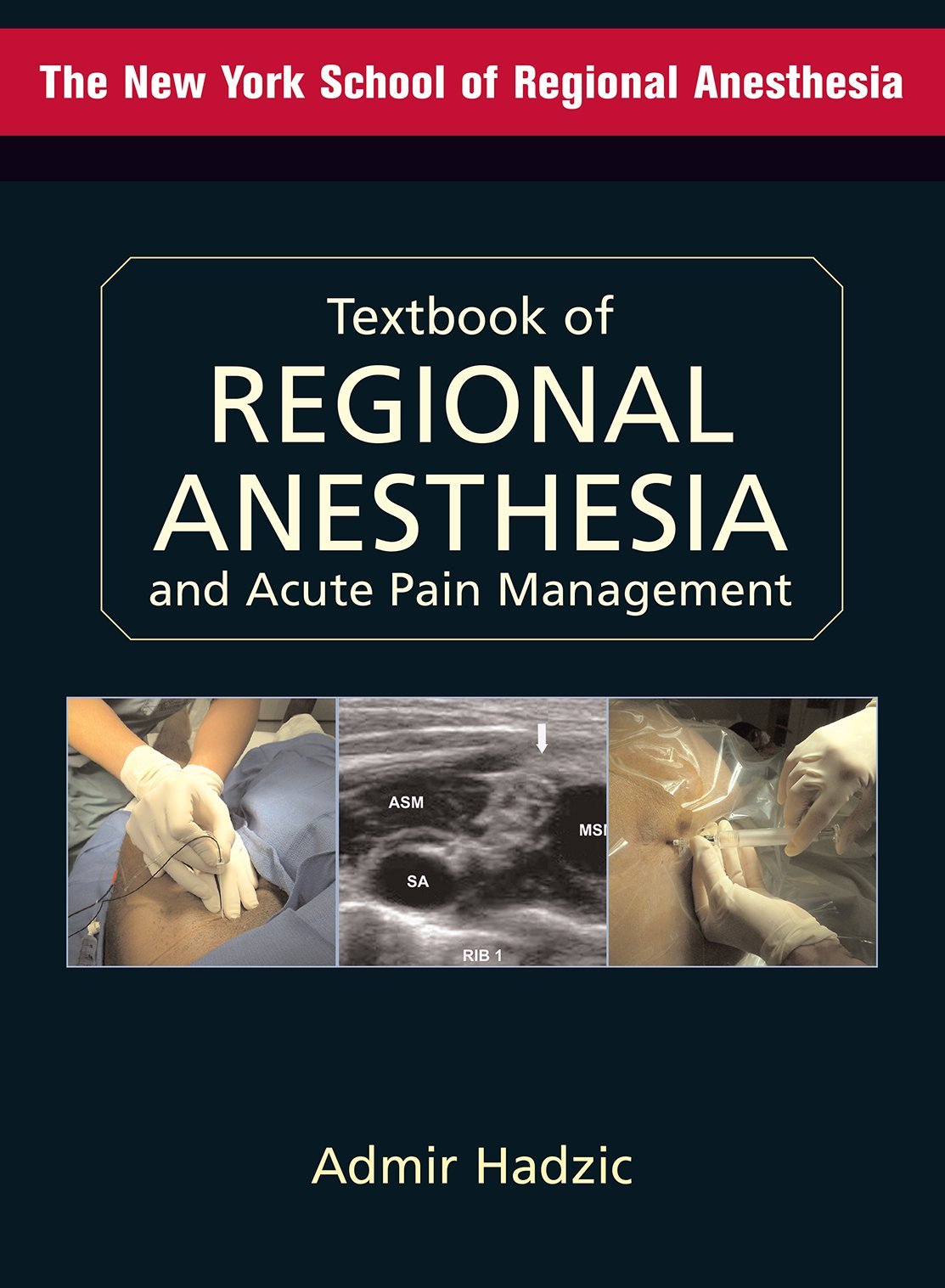 Textbook of Regional Anesthesia and Acute Pain Management (Hadzic, Textbook of Regional Anesthesia and Acute Pain Management),Used