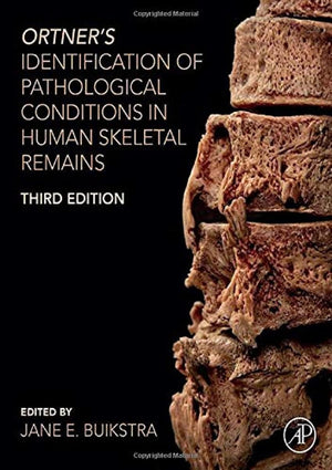 Ortner's Identification of Pathological Conditions in Human Skeletal Remains,Used