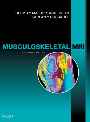 Musculoskeletal Mri