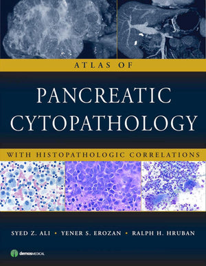 Atlas of Pancreatic Cytopathology: With Histopathologic Correlations,Used